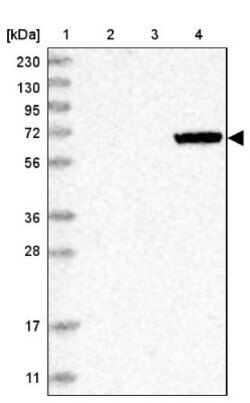 MASP2 Antibody, Novus Biologicals 0.1mL; Unlabeled:Antibodies, Polyclonal